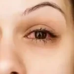 eye_flu_1689665536